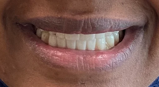 Patient Eleven After