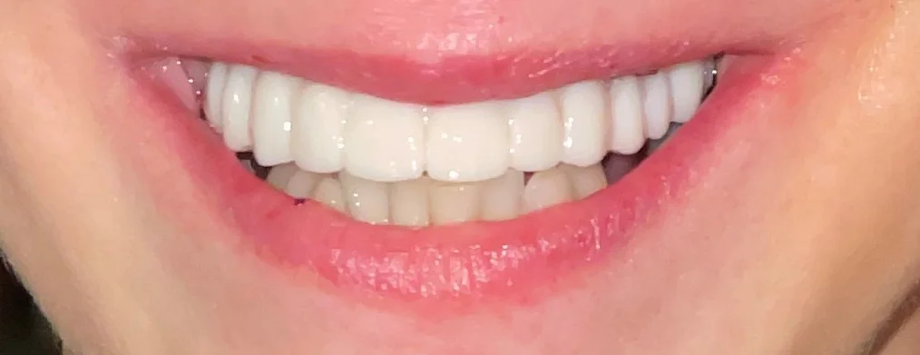 Patient Five After