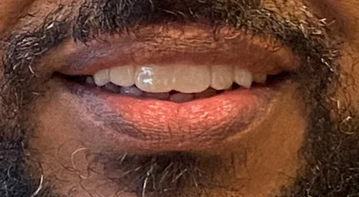 Patient Twelfth After