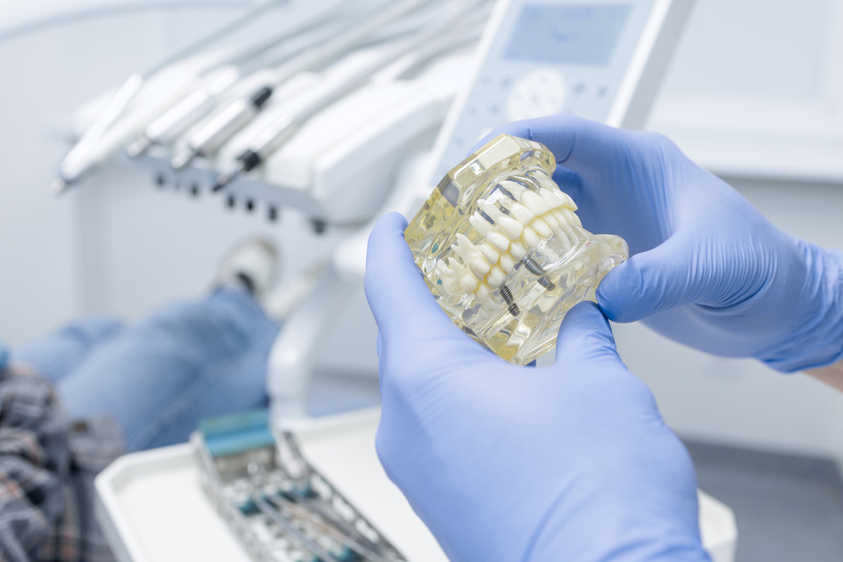 Close up of gloved hands showing jaw model with dental implants in clinic for consultation and restorative treatment planning